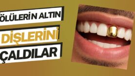 ALTIN DİS