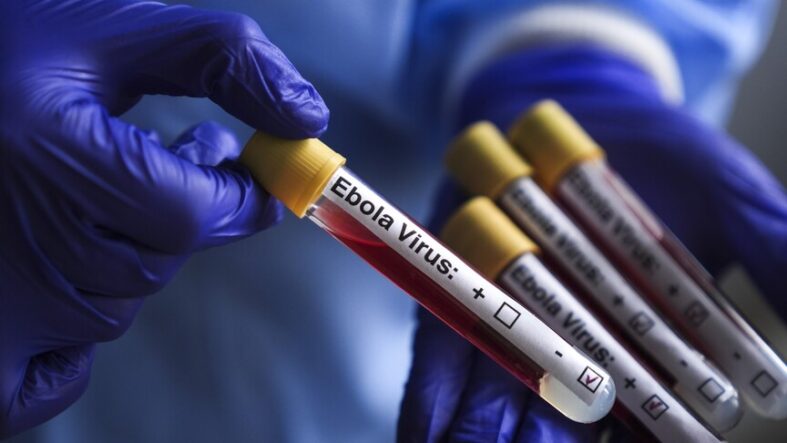 Ebola Virüs