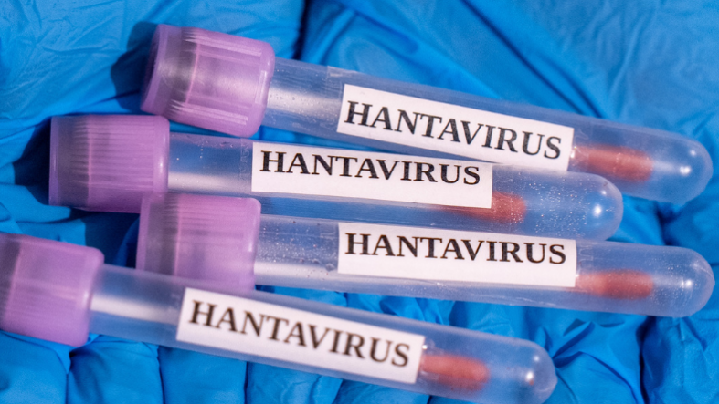 Hantavirüs